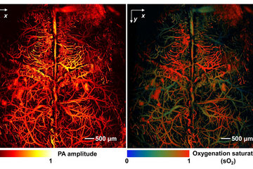Listening with Lasers: Hybrid Technique Sees Into Human Body